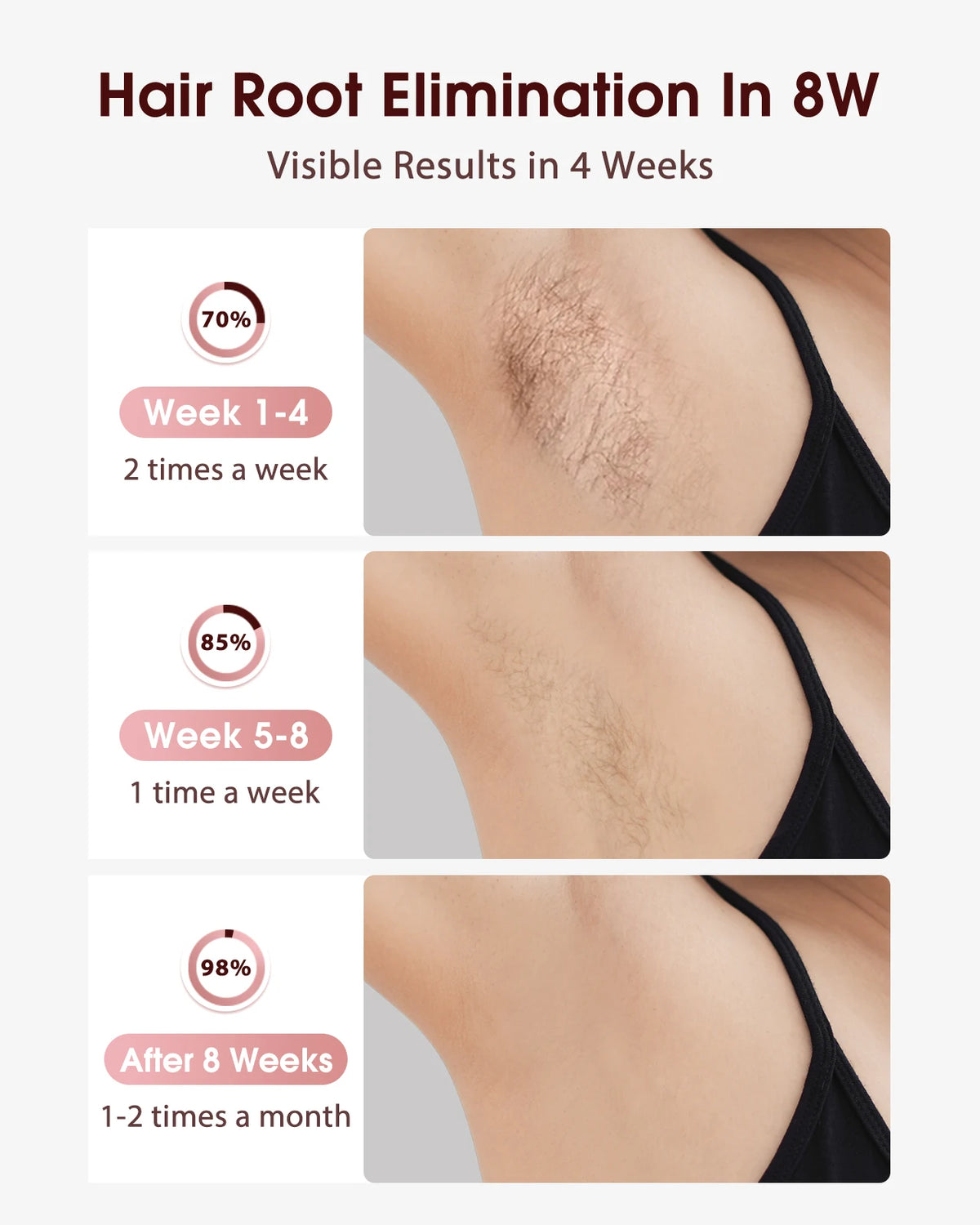Totmizby Portable IPL Ice Cooling Laser Hair Removal Device