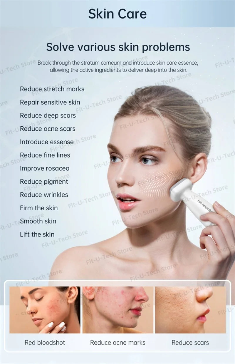 Adjustable 120 Pin Derma Stamp For Face And Beard Treatment