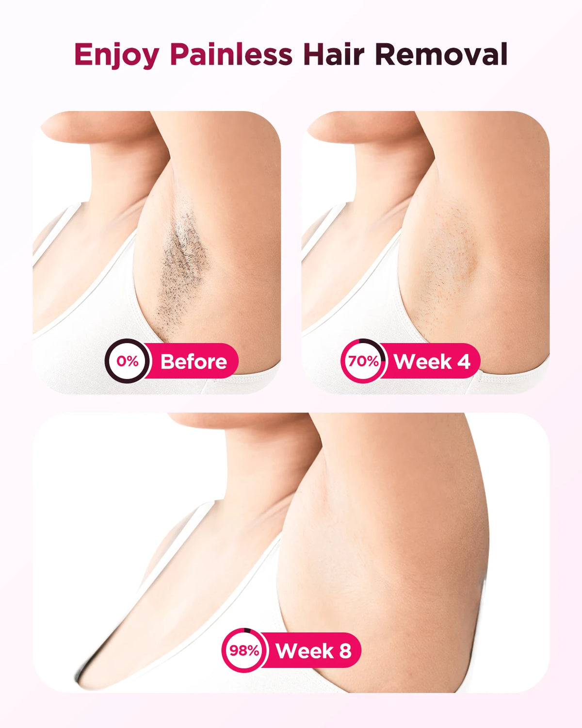 Totmizby IPL Laser Epilator Painless Permanent Hair Remover