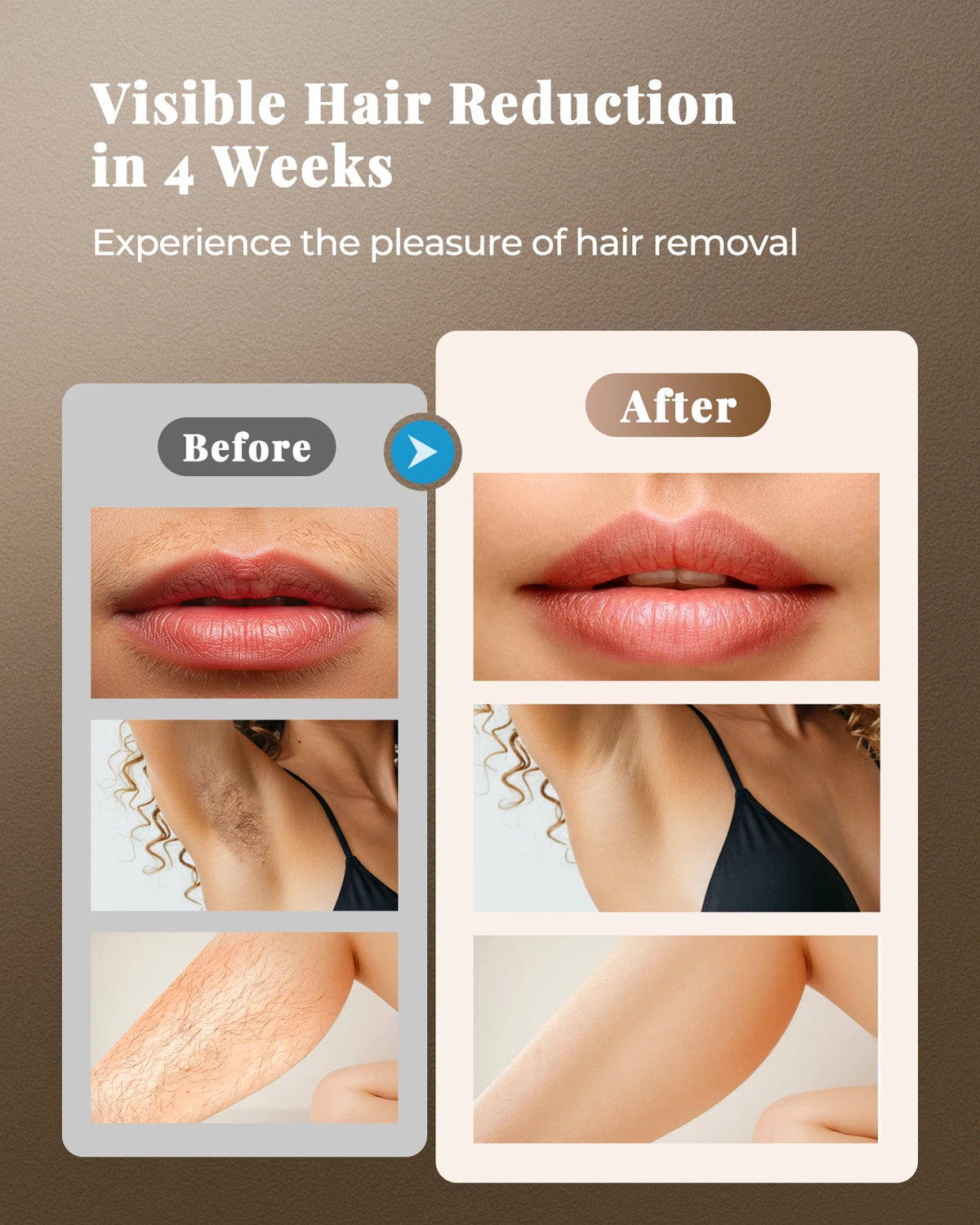 Totmizby Ipl Hair Removal Device For Whole Body And Facial Use