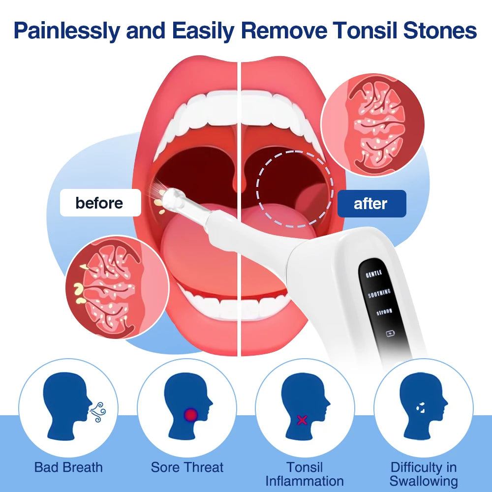 Hailicare Electric Tonsil Stone Remover With UV Hygienic Case